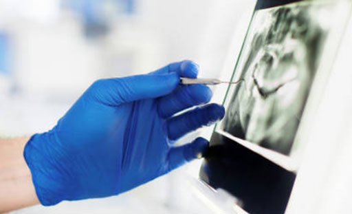 Dental X-Rays Frisco TX